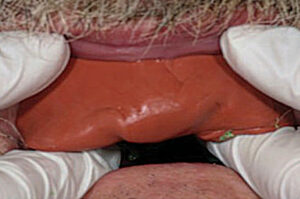 Teeth in putty matrix