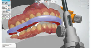 Occlusal guard