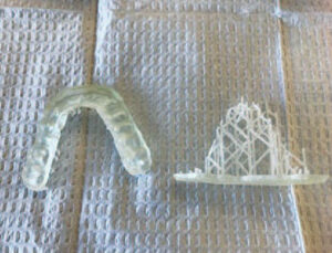 Occlusal guard