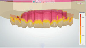 Scanned arches