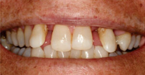 Preop clinical photograph
