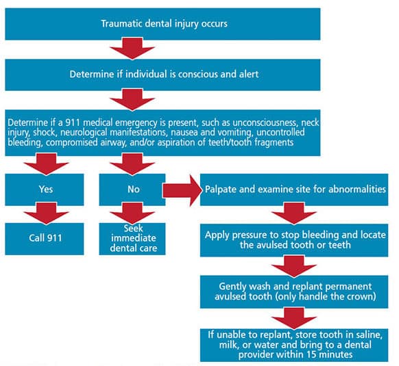 Dental Trauma flow chart