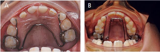 Quad-helix expander