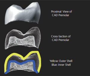 Tooth Preparation Considerations for CAD/CAM Materials in Restorative ...