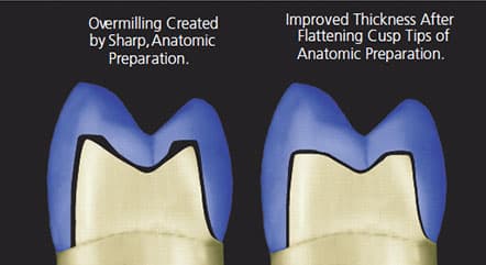 cad cam crowns