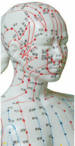 Acupuncture