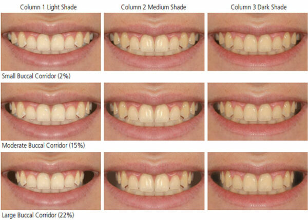 Auswirkungen der Zahnaufhellung auf das Auftreten von Crowding und