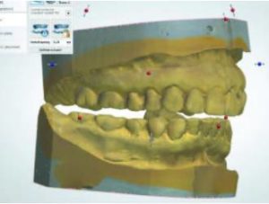 Scanned casts