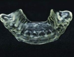 Finished occlusal splint