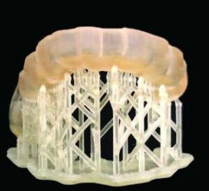 Printed occlusal appliance