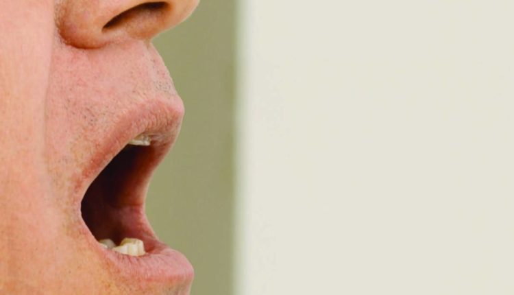 Frequently Asked Questions  Xylimelts: dry mouth remedies