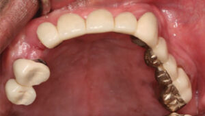 Maxillary view