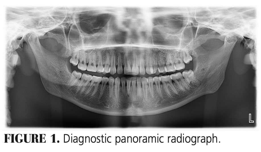 Optimal Panorex Imaging Decisions in Dentistry