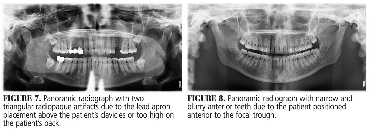 Optimal Panorex Imaging Decisions in Dentistry