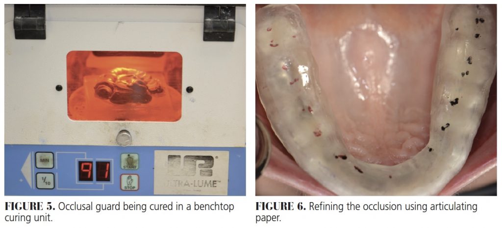 occlusal figure