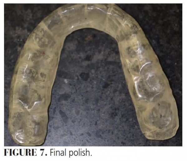 Alternative Method for Occlusal Guard Fabrication Decisions in Dentistry