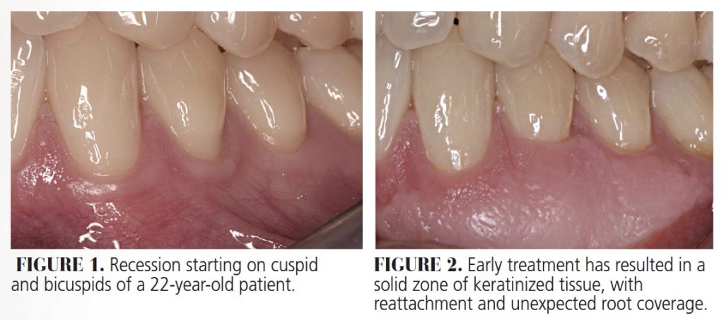 palatal figure