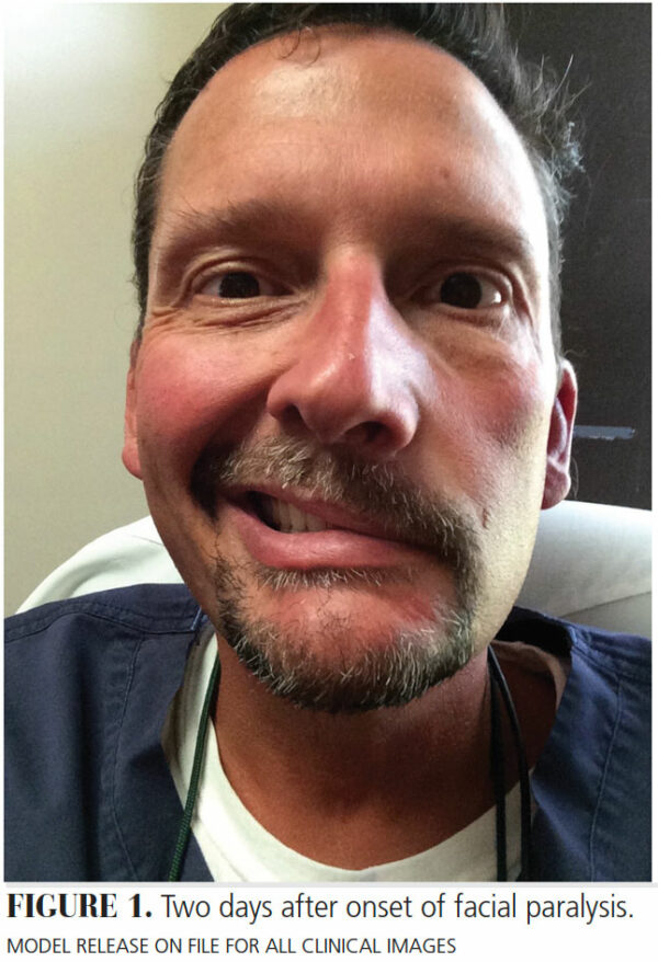 Differential Diagnosis for Acute Facial Paralysis Decisions in Dentistry