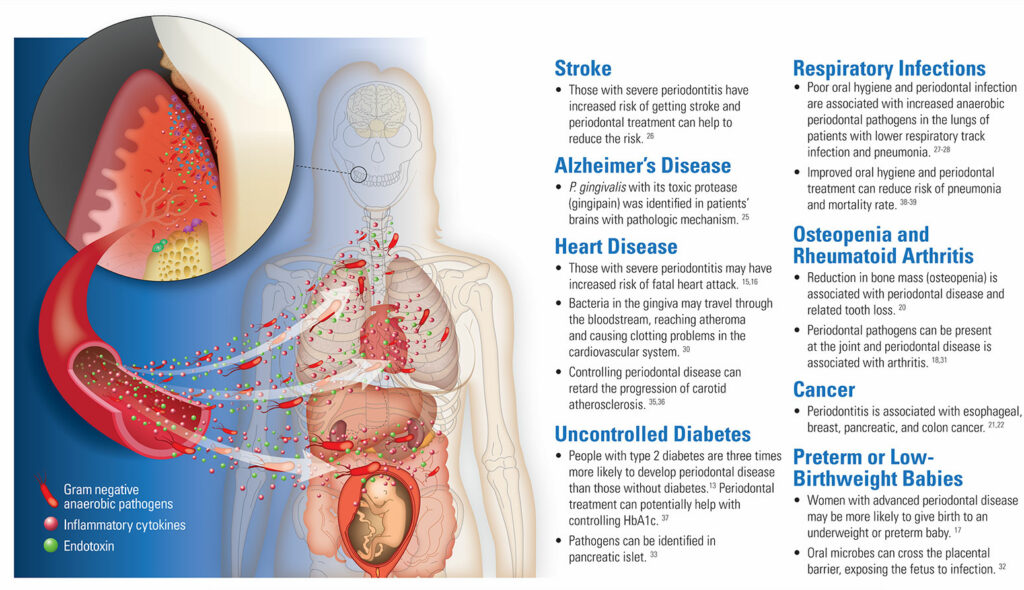 perio systemic health figure