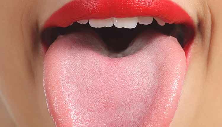 Changes in Tongue Appearance May Indicate COVID-19 Infection - Decisions in Dentistry