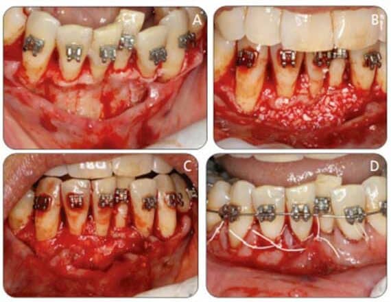 Case report for orthodontic care