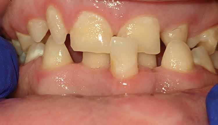 Oral Health: Clinical Case Scenario Assignment.