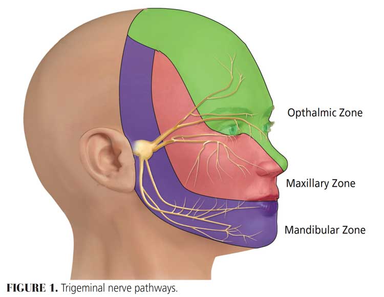 Can Dental Surgery Cause Trigeminal Neuralgia?