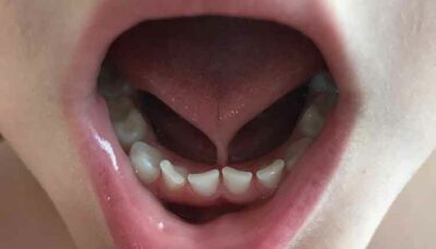 close up of open mouth