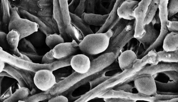 enzymes