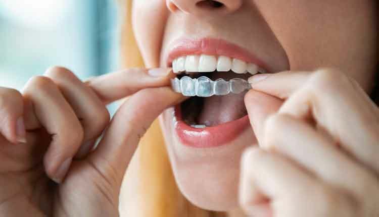 How Dentists Can Profit From Invisalign - Decisions in Dentistry