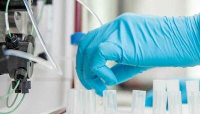A researcher prepares samples for fast protein liquid chromatography in order to purify the proteins in a bacterial lysate.