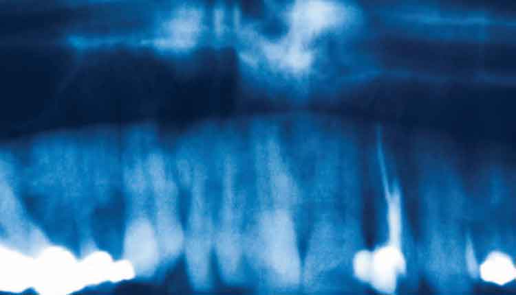 xray
