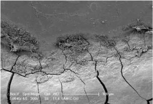 FIGURE 3. View of the cementoenamel junction showing calculus and biofilm deposits. Original magnification 300x.