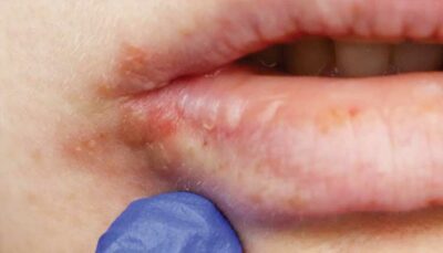 close up of mouth