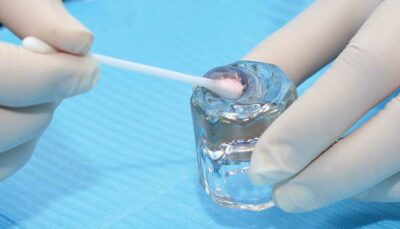close up of dental professional's hands holding q-tip