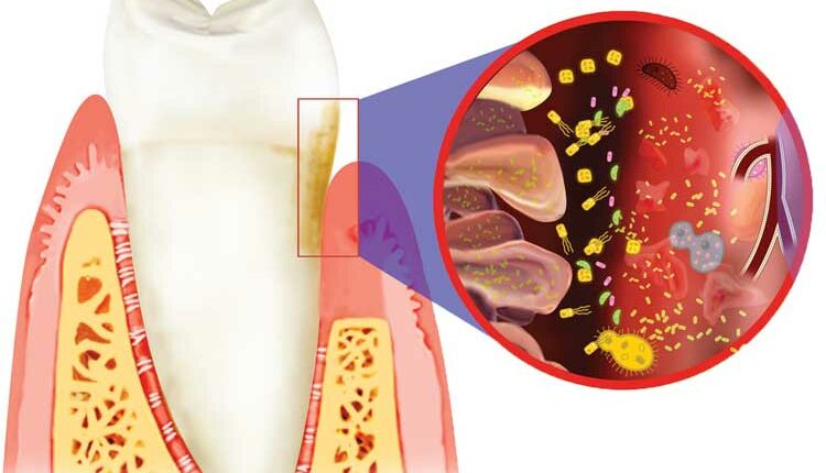 1121-did-oral-systemics-1