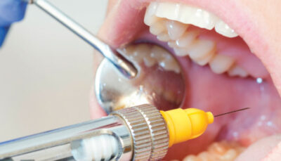 close up of dental procedure
