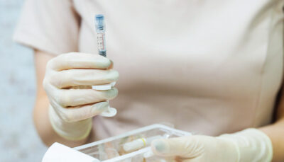 woman holding dermal fillers