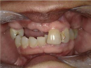 FIGURE 1. Preoperative extraoral view.