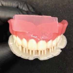 FIGURE 11. Base and teeth spot bonded with ultraviolet light.