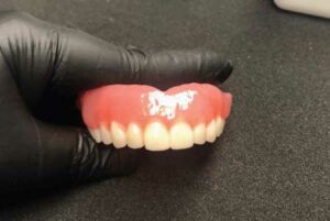 FIGURE 12. Finished and polished denture.