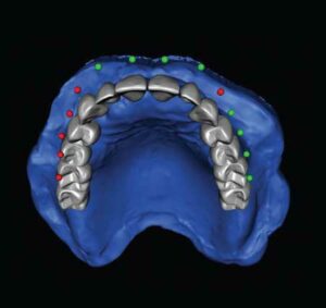 FIGURE 8. Proper tooth placement and gingival contouring.