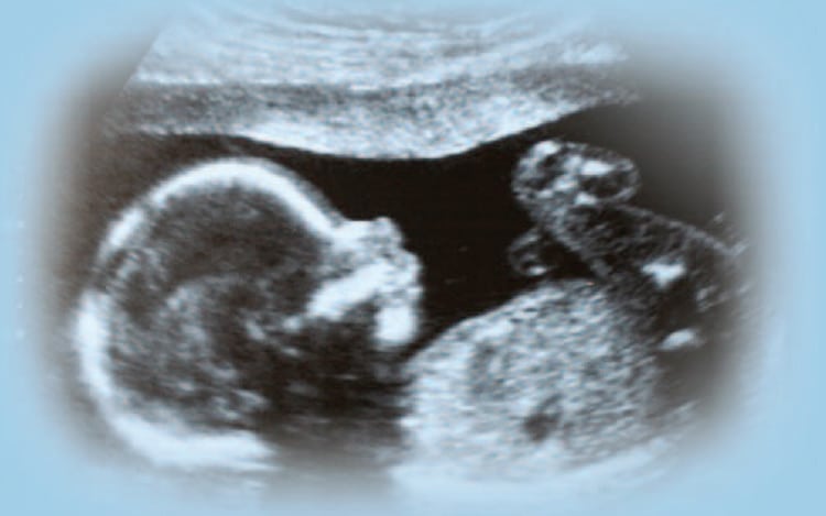 ultrasound of a baby