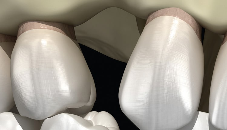 Essential requirements of a non-occlusal mandibu- lar reference position