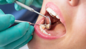 Dentist holding dental instruments in young woman's mouth