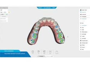 aligner software
