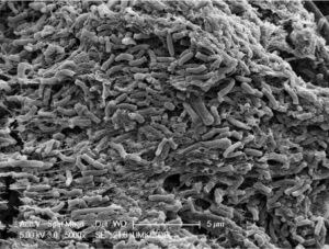 FIGURE 2. The image shows a magnified area of the retained calculus shown in Figure 1. The depression in the calculus is filled with extracellular protein matrix, with embedded masses of rod-shaped bacteria.