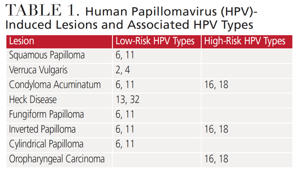 Head And Neck Lesions Associated With The Human Papillomavirus Decisions In Dentistry 