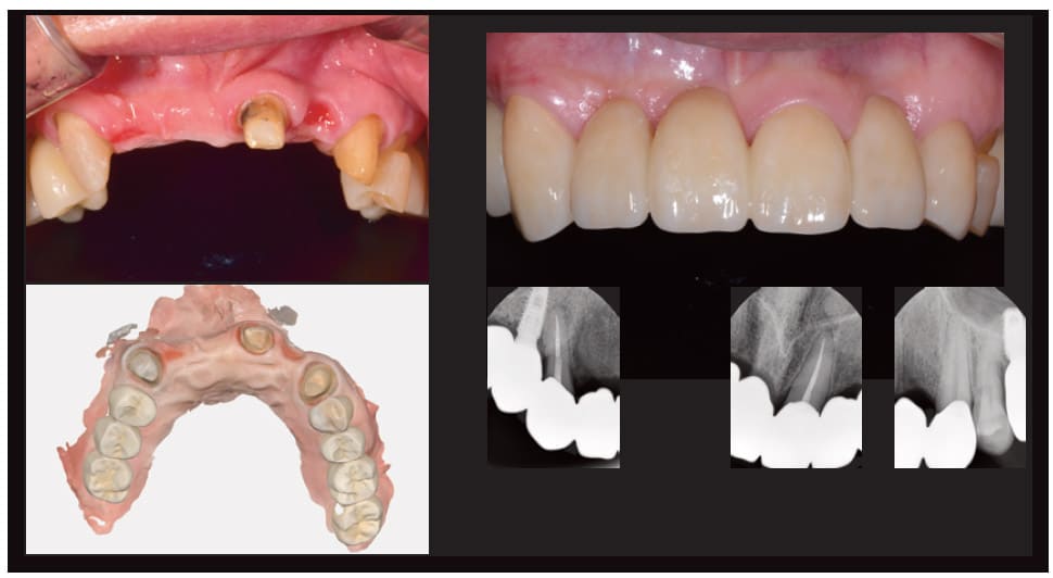 Digital Dentistry Begins With Intraoral - in Dentistry