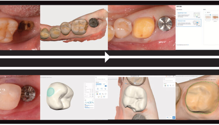 intraoral-scanning-9